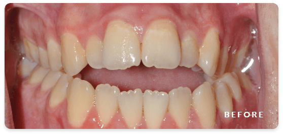 before image