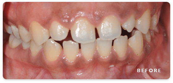 before image